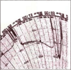 Core Temperature Chart